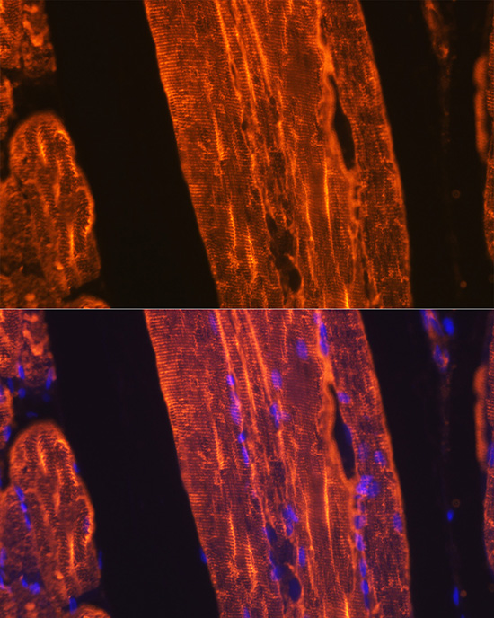 A Alpha-Actin-1 (ACTA1) Rabbit monoclonal antibody