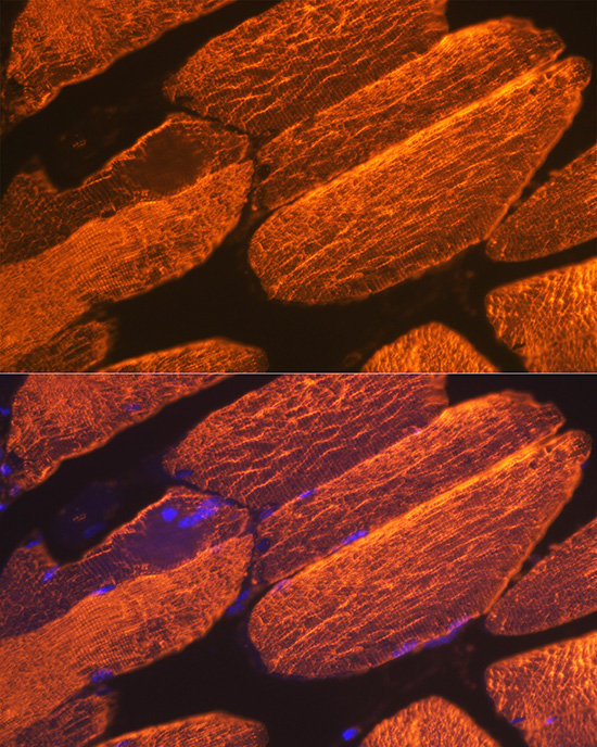 A Alpha-Actin-1 (ACTA1) Rabbit monoclonal antibody