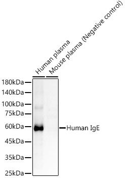 Human IgE Rabbit monoclonal antibody