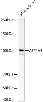 ATP1A4 Rabbit monoclonal antibody