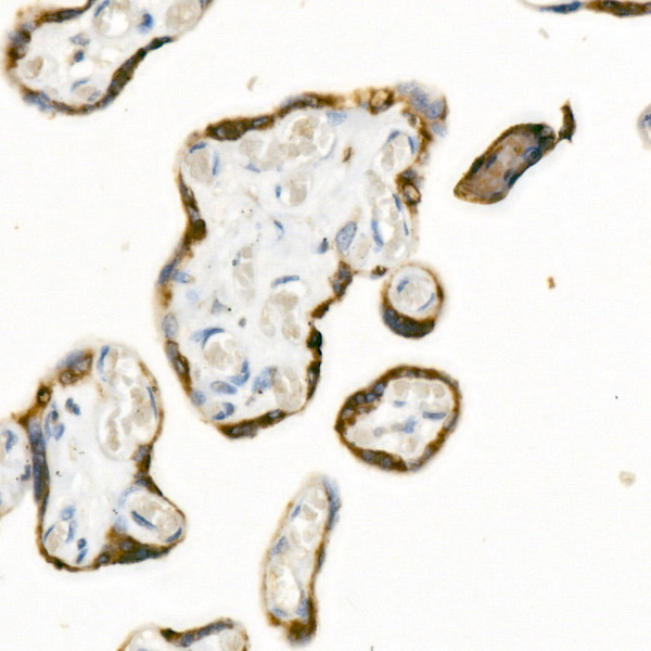 ATP1A4 Rabbit monoclonal antibody