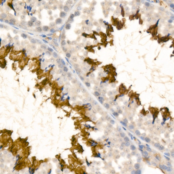 ATP1A4 Rabbit monoclonal antibody