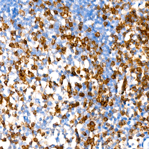CD2 Rabbit monoclonal antibody