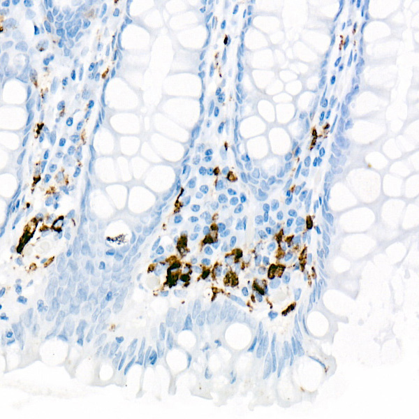 CD68 Rabbit monoclonal antibody