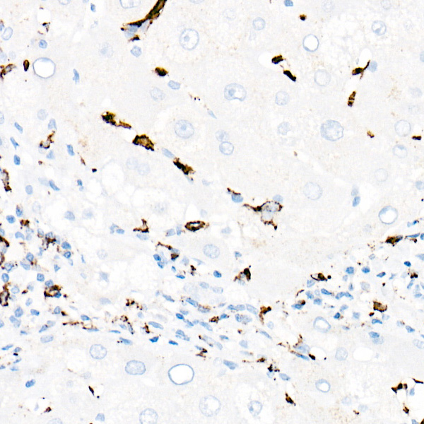 CD68 Rabbit monoclonal antibody