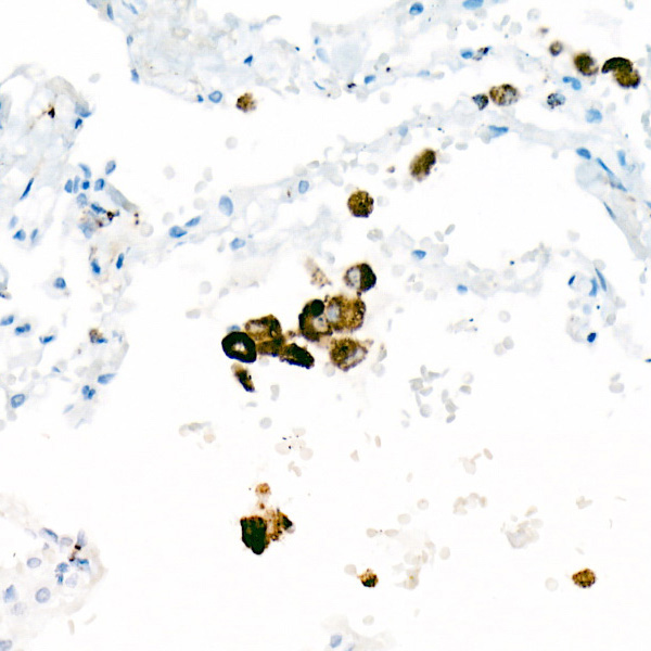 CD68 Rabbit monoclonal antibody