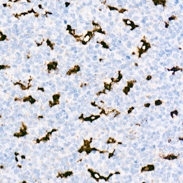 CD68 Rabbit monoclonal antibody
