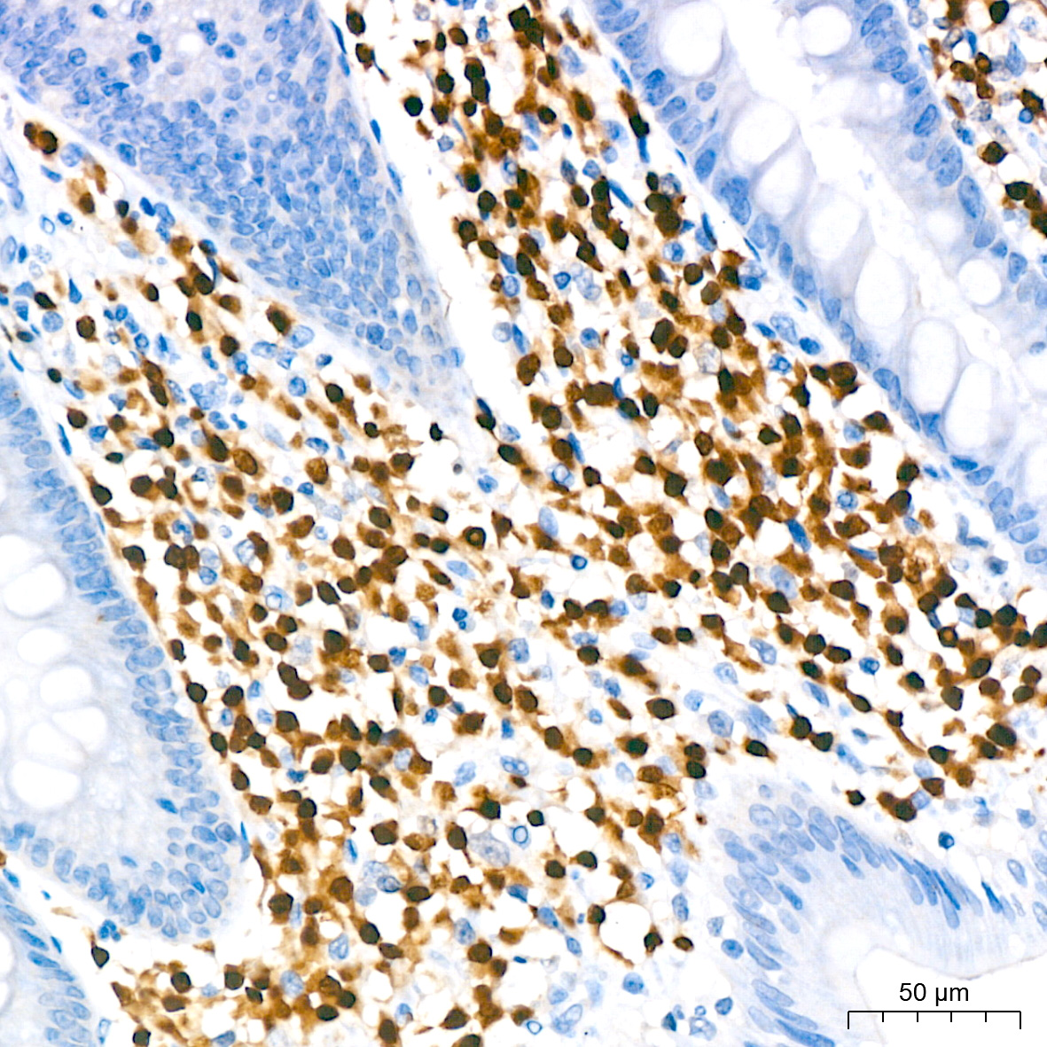 MUM1 Rabbit monoclonal antibody