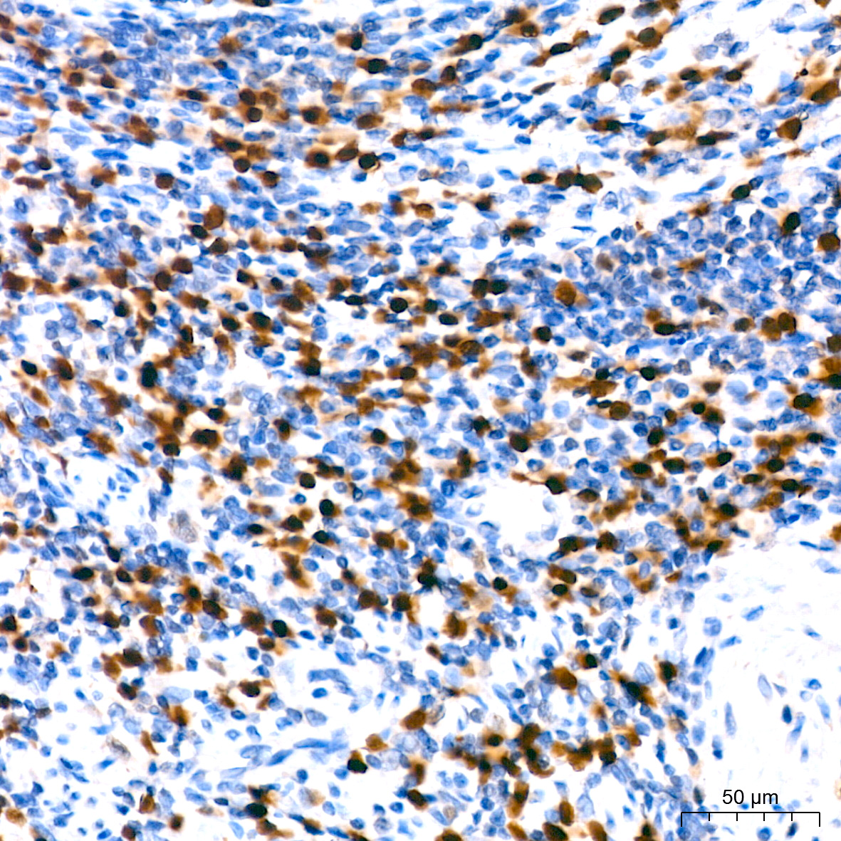 MUM1 Rabbit monoclonal antibody