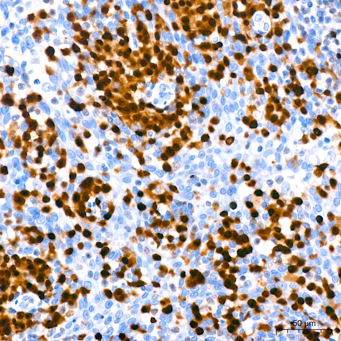 MUM1 Rabbit monoclonal antibody