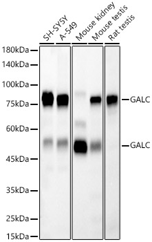 [KD Validated] GALC Rabbit monoclonal antibody