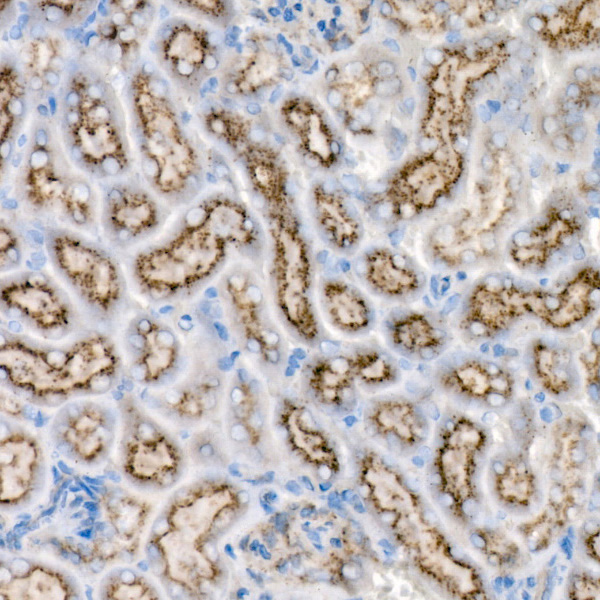 [KD Validated] GALC Rabbit monoclonal antibody