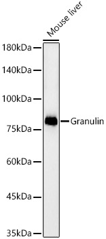 Granulin Rabbit monoclonal antibody