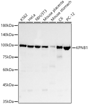KPNB1 Rabbit monoclonal antibody