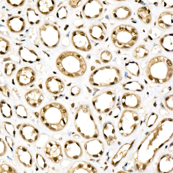 KPNB1 Rabbit monoclonal antibody