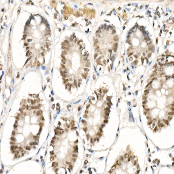 GLI1 Rabbit monoclonal antibody