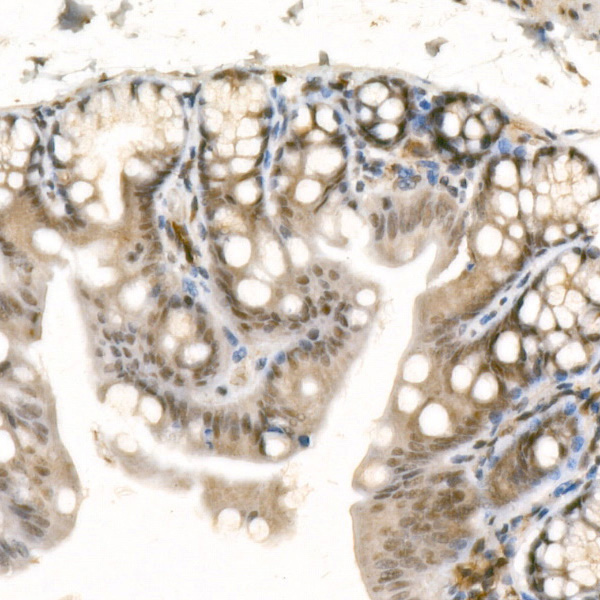 GLI1 Rabbit monoclonal antibody