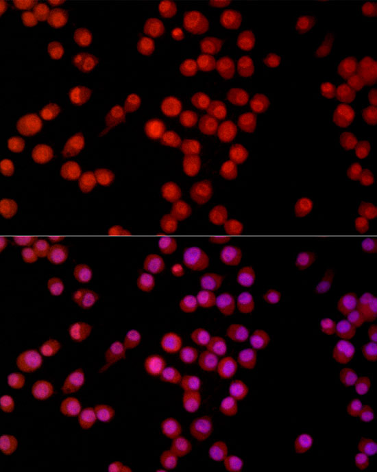 GLI1 Rabbit monoclonal antibody