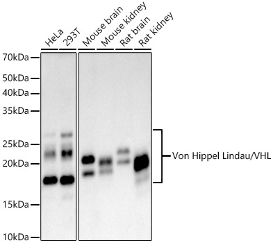 [KO Validated] Von Hippel Lindau/VHL Rabbit monoclonal antibody