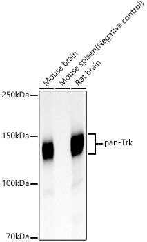 pan-Trk Rabbit monoclonal antibody