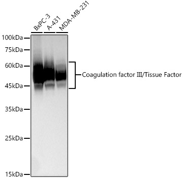 Coagulation factor III/Tissue Factor Rabbit mAb