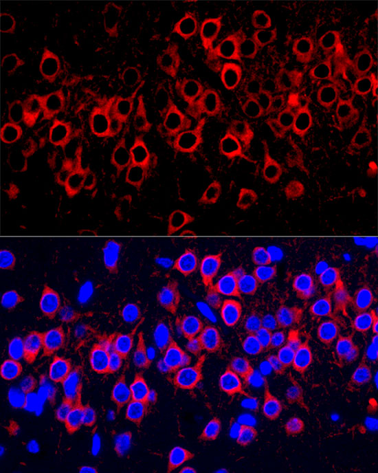 WFS1 Rabbit monoclonal antibody