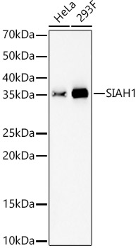 SIAH1 Rabbit monoclonal antibody