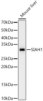 SIAH1 Rabbit monoclonal antibody