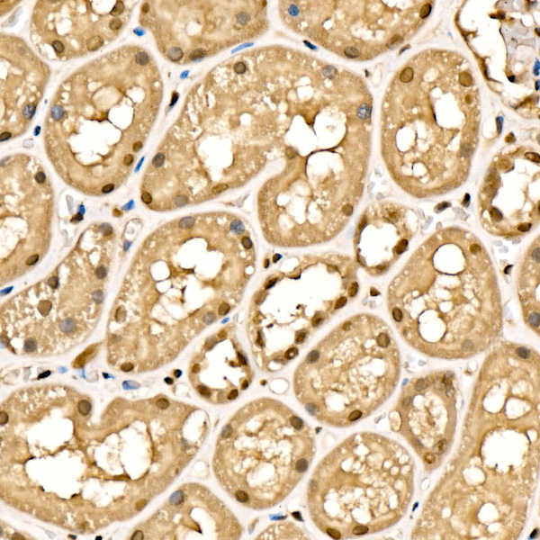 SIAH1 Rabbit monoclonal antibody