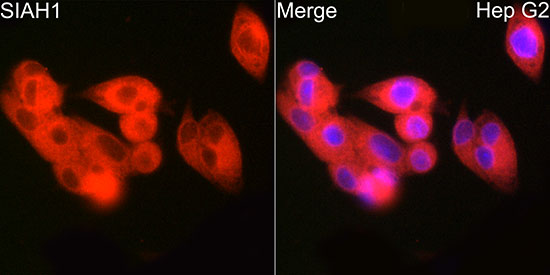 SIAH1 Rabbit monoclonal antibody