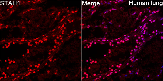 SIAH1 Rabbit monoclonal antibody