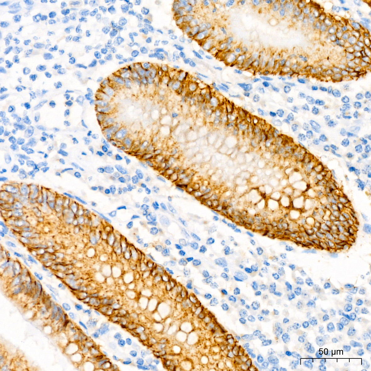 CD138/Syndecan-1 Rabbit monoclonal antibody