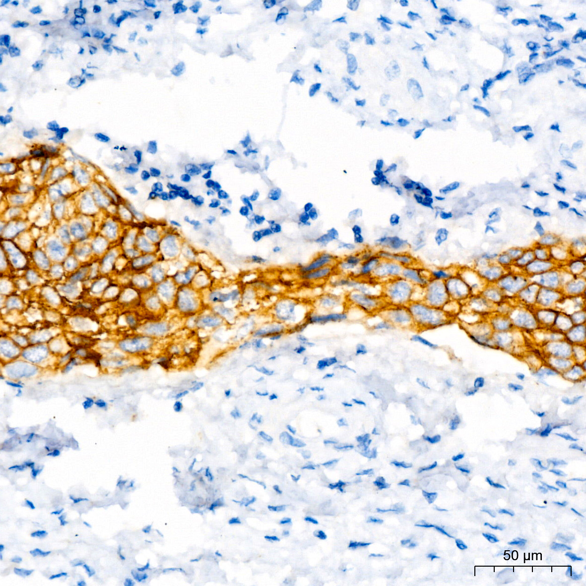 CD138/Syndecan-1 Rabbit monoclonal antibody