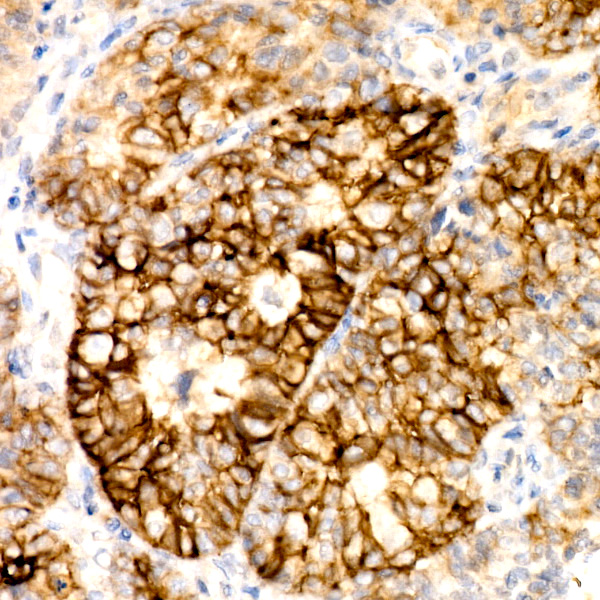 CD138/Syndecan-1 Rabbit monoclonal antibody
