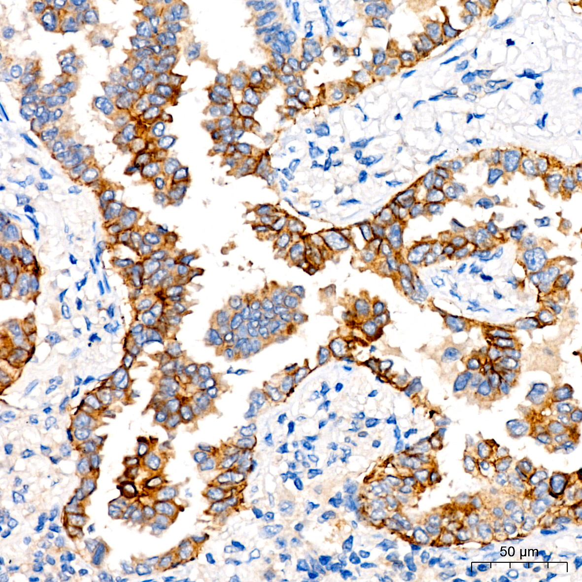 CD138/Syndecan-1 Rabbit monoclonal antibody
