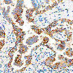 Immunohistochemistry - CD138/Syndecan-1 Rabbit mAb (A23248)