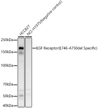 EGF Receptor (E746-A750del Specific) Rabbit  pAb