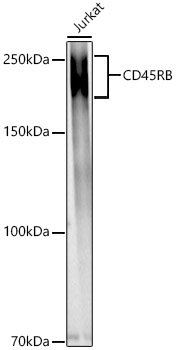 CD45RB Rabbit polyclonal antibody