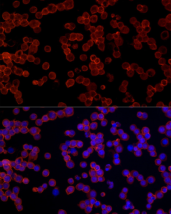 CD45RB Rabbit polyclonal antibody