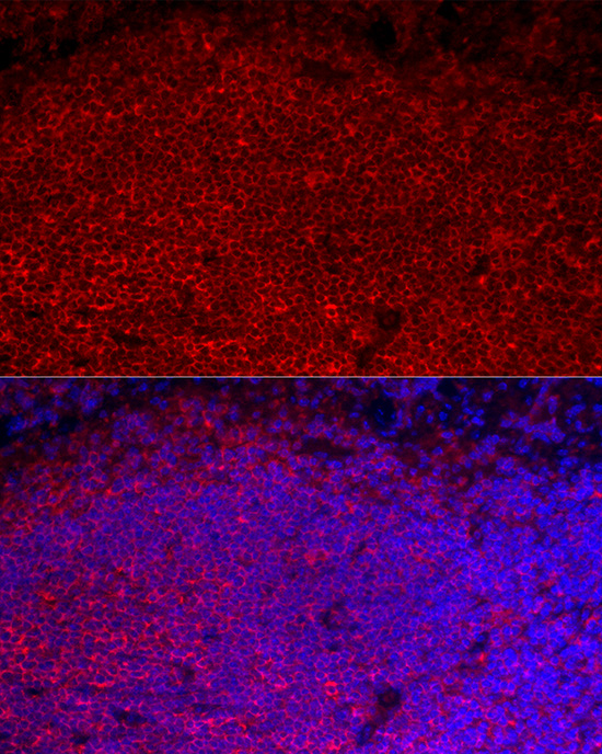 CD45RB Rabbit polyclonal antibody