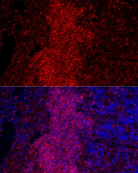 CD45RB Rabbit polyclonal antibody