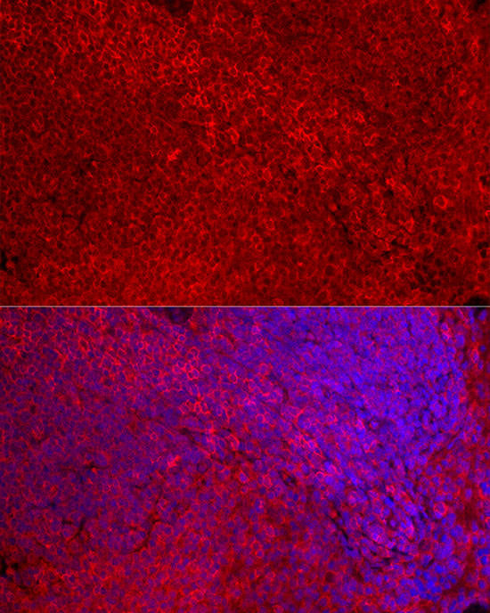 CD4 Rabbit polyclonal antibody