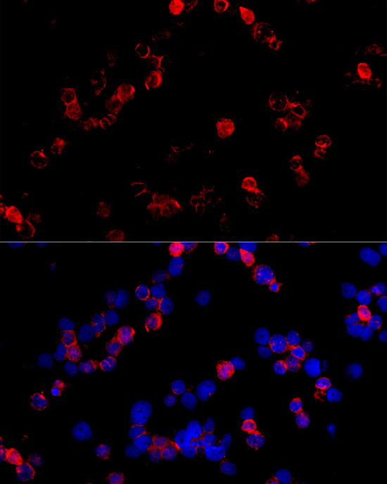 CD4 Rabbit polyclonal antibody