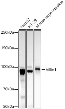 Villin1 Rabbit monoclonal antibody