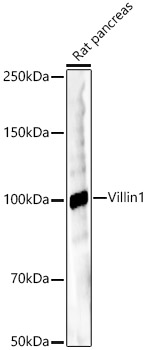 Villin1 Rabbit monoclonal antibody