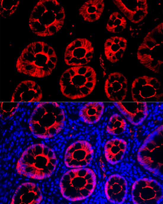 Villin1 Rabbit monoclonal antibody