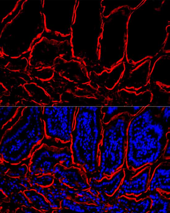 Villin1 Rabbit monoclonal antibody