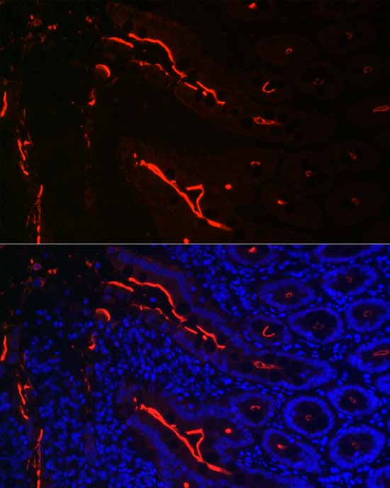 Villin1 Rabbit monoclonal antibody