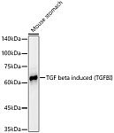 Western blot - TGF beta induced (TGFBI)  Rabbit mAb (A23275)