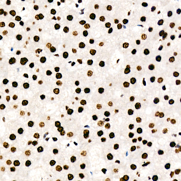 HNRNPD Rabbit monoclonal antibody